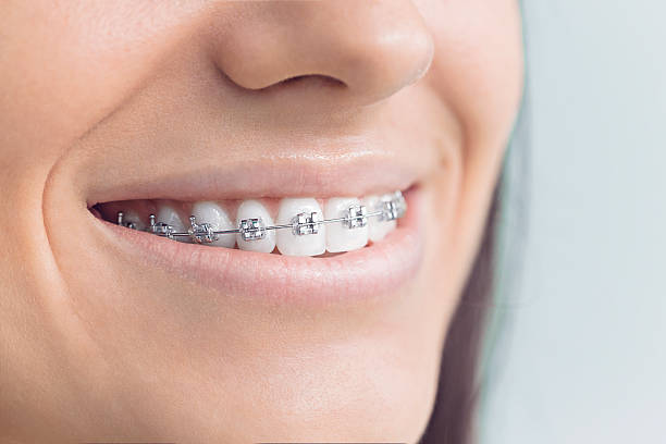 Best Invisalign and Clear Aligners  in Munford, TN